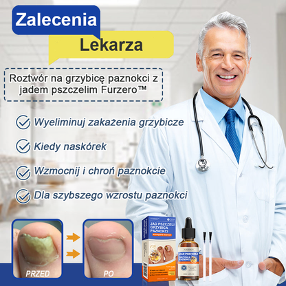 🐝🐝 Bienengift Nailpilz Treatment: Complete solution to the problem of nail fungus🌟👣