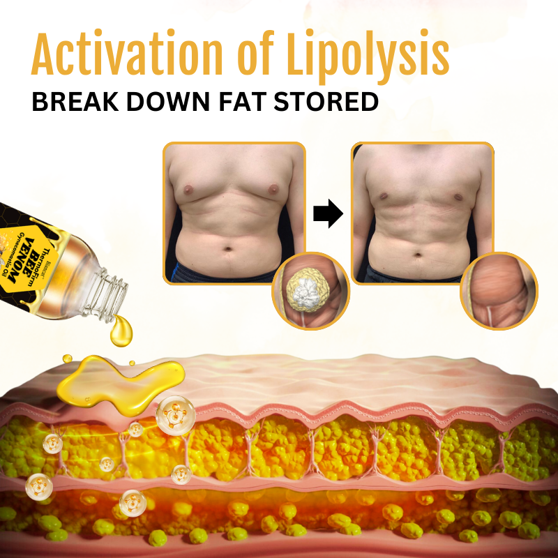 Dresfa™ ThermoFirm Bee Venom Gynecomastia Oil