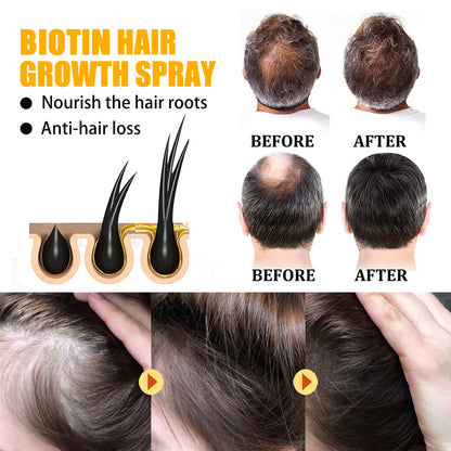 HOT SALE 🔥Biotin hair spray🔥 For thicker, stronger hair in just a few weeks